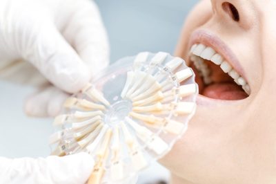 close-up-partial-view-of-dentist-comparing-teeth-o-2024-11-17-14-44-27-utc (1)