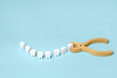 tooth-extraction-with-a-dental-instrument-with-for-2026-01-06-09-01-22-utc